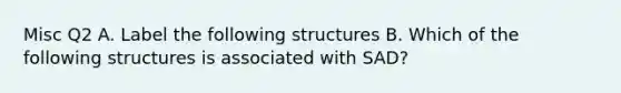 Misc Q2 A. Label the following structures B. Which of the following structures is associated with SAD?