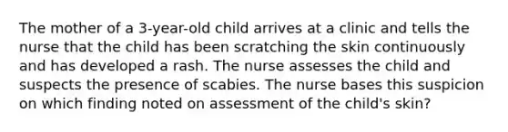 The mother of a 3-year-old child arrives at a clinic and tells the nurse that the child has been scratching the skin continuously and has developed a rash. The nurse assesses the child and suspects the presence of scabies. The nurse bases this suspicion on which finding noted on assessment of the child's skin?