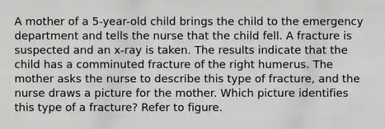 A mother of a 5-year-old child brings the child to the emergency department and tells the nurse that the child fell. A fracture is suspected and an x-ray is taken. The results indicate that the child has a comminuted fracture of the right humerus. The mother asks the nurse to describe this type of fracture, and the nurse draws a picture for the mother. Which picture identifies this type of a fracture? Refer to figure.