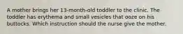 A mother brings her 13-month-old toddler to the clinic. The toddler has erythema and small vesicles that ooze on his buttocks. Which instruction should the nurse give the mother.