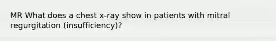 MR What does a chest x-ray show in patients with mitral regurgitation (insufficiency)?