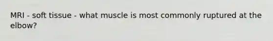 MRI - soft tissue - what muscle is most commonly ruptured at the elbow?