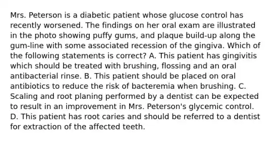 Mrs. Peterson is a diabetic patient whose glucose control has recently worsened. The findings on her oral exam are illustrated in the photo showing puffy gums, and plaque build-up along the gum-line with some associated recession of the gingiva. Which of the following statements is correct? A. This patient has gingivitis which should be treated with brushing, flossing and an oral antibacterial rinse. B. This patient should be placed on oral antibiotics to reduce the risk of bacteremia when brushing. C. Scaling and root planing performed by a dentist can be expected to result in an improvement in Mrs. Peterson's glycemic control. D. This patient has root caries and should be referred to a dentist for extraction of the affected teeth.