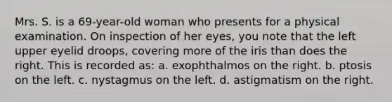 Mrs. S. is a 69-year-old woman who presents for a physical examination. On inspection of her eyes, you note that the left upper eyelid droops, covering more of the iris than does the right. This is recorded as: a. exophthalmos on the right. b. ptosis on the left. c. nystagmus on the left. d. astigmatism on the right.