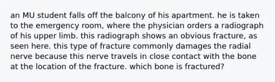 an MU student falls off the balcony of his apartment. he is taken to the emergency room, where the physician orders a radiograph of his upper limb. this radiograph shows an obvious fracture, as seen here. this type of fracture commonly damages the radial nerve because this nerve travels in close contact with the bone at the location of the fracture. which bone is fractured?