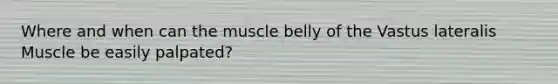 Where and when can the muscle belly of the Vastus lateralis Muscle be easily palpated?