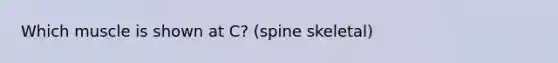 Which muscle is shown at C? (spine skeletal)