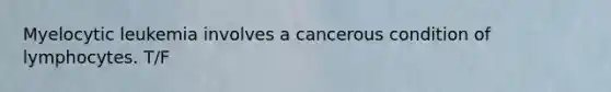 Myelocytic leukemia involves a cancerous condition of lymphocytes. T/F