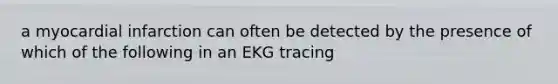 a myocardial infarction can often be detected by the presence of which of the following in an EKG tracing