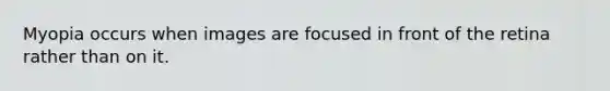 Myopia occurs when images are focused in front of the retina rather than on it.