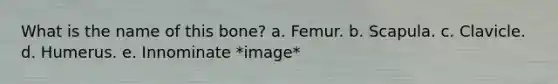 What is the name of this bone? a. Femur. b. Scapula. c. Clavicle. d. Humerus. e. Innominate *image*