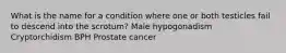 What is the name for a condition where one or both testicles fail to descend into the scrotum? Male hypogonadism Cryptorchidism BPH Prostate cancer