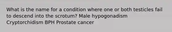 What is the name for a condition where one or both testicles fail to descend into the scrotum? Male hypogonadism Cryptorchidism BPH Prostate cancer