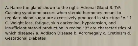 A. Name the gland shown to the right: Adrenal Gland B. T/F: Cushing syndrome occurs when steroid hormones meant to regulate blood sugar are excessively produced in structure "A." ? C. Weight loss, fatigue, skin darkening, hypotension, and insufficient steroid production in region "B" are characteristics of which disease? a. Addison Disease b. Acromegaly c. Cretinism d. Gestational Diabetes