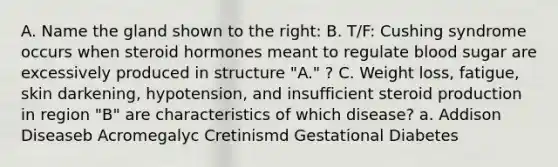 A. Name the gland shown to the right: B. T/F: Cushing syndrome occurs when steroid hormones meant to regulate blood sugar are excessively produced in structure "A." ? C. Weight loss, fatigue, skin darkening, hypotension, and insufficient steroid production in region "B" are characteristics of which disease? a. Addison Diseaseb Acromegalyc Cretinismd Gestational Diabetes