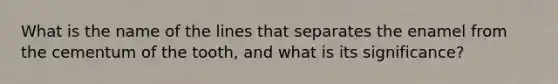 What is the name of the lines that separates the enamel from the cementum of the tooth, and what is its significance?