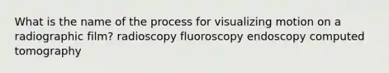 What is the name of the process for visualizing motion on a radiographic film? radioscopy fluoroscopy endoscopy computed tomography