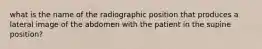 what is the name of the radiographic position that produces a lateral image of the abdomen with the patient in the supine position?