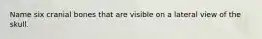 Name six cranial bones that are visible on a lateral view of the skull.