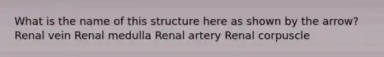 What is the name of this structure here as shown by the arrow? Renal vein Renal medulla Renal artery Renal corpuscle