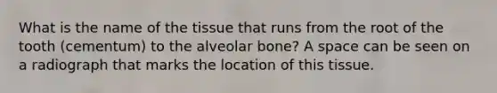 What is the name of the tissue that runs from the root of the tooth (cementum) to the alveolar bone? A space can be seen on a radiograph that marks the location of this tissue.