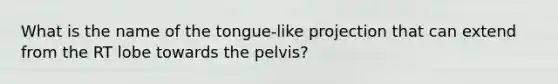 What is the name of the tongue-like projection that can extend from the RT lobe towards the pelvis?