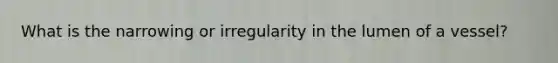 What is the narrowing or irregularity in the lumen of a vessel?