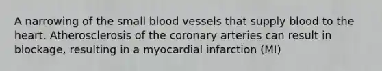 A narrowing of the small blood vessels that supply blood to the heart. Atherosclerosis of the coronary arteries can result in blockage, resulting in a myocardial infarction (MI)