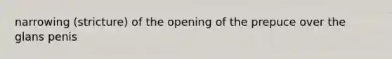 narrowing (stricture) of the opening of the prepuce over the glans penis