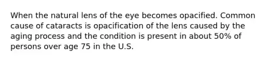 When the natural lens of the eye becomes opacified. Common cause of cataracts is opacification of the lens caused by the aging process and the condition is present in about 50% of persons over age 75 in the U.S.