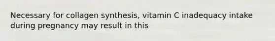 Necessary for collagen synthesis, vitamin C inadequacy intake during pregnancy may result in this