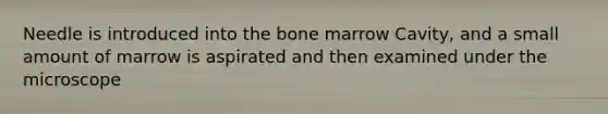 Needle is introduced into the bone marrow Cavity, and a small amount of marrow is aspirated and then examined under the microscope