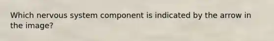 Which nervous system component is indicated by the arrow in the image?