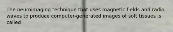 The neuroimaging technique that uses magnetic fields and radio waves to produce computer-generated images of soft tissues is called