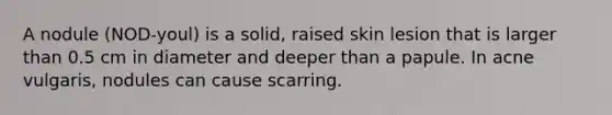 A nodule (NOD-youl) is a solid, raised skin lesion that is larger than 0.5 cm in diameter and deeper than a papule. In acne vulgaris, nodules can cause scarring.