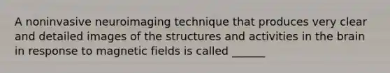 A noninvasive neuroimaging technique that produces very clear and detailed images of the structures and activities in the brain in response to magnetic fields is called ______