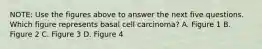 NOTE: Use the figures above to answer the next five questions. Which figure represents basal cell carcinoma? A. Figure 1 B. Figure 2 C. Figure 3 D. Figure 4