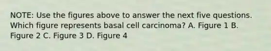 NOTE: Use the figures above to answer the next five questions. Which figure represents basal cell carcinoma? A. Figure 1 B. Figure 2 C. Figure 3 D. Figure 4