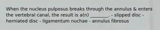 When the nucleus pulposus breaks through the annulus & enters the vertebral canal, the result is a(n) ________. - slipped disc - herniated disc - ligamentum nuchae - annulus fibrosus