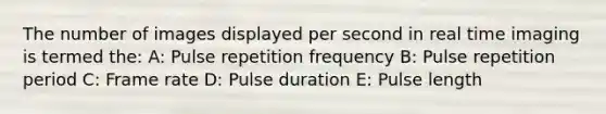 The number of images displayed per second in real time imaging is termed the: A: Pulse repetition frequency B: Pulse repetition period C: Frame rate D: Pulse duration E: Pulse length