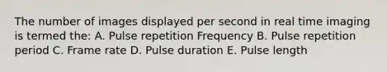 The number of images displayed per second in real time imaging is termed the: A. Pulse repetition Frequency B. Pulse repetition period C. Frame rate D. Pulse duration E. Pulse length