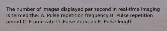 The number of images displayed per second in real-time imaging is termed the: A. Pulse repetition frequency B. Pulse repetition period C. Frame rate D. Pulse duration E. Pulse length