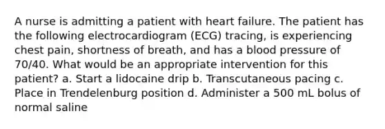 A nurse is admitting a patient with heart failure. The patient has the following electrocardiogram (ECG) tracing, is experiencing chest pain, shortness of breath, and has a blood pressure of 70/40. What would be an appropriate intervention for this patient? a. Start a lidocaine drip b. Transcutaneous pacing c. Place in Trendelenburg position d. Administer a 500 mL bolus of normal saline