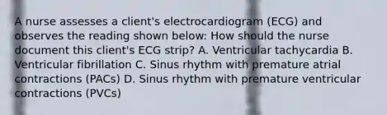 A nurse assesses a client's electrocardiogram (ECG) and observes the reading shown below: How should the nurse document this client's ECG strip? A. Ventricular tachycardia B. Ventricular fibrillation C. Sinus rhythm with premature atrial contractions (PACs) D. Sinus rhythm with premature ventricular contractions (PVCs)