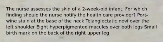 The nurse assesses the skin of a 2-week-old infant. For which finding should the nurse notify the health care provider? Port-wine stain at the base of the neck Telangiectatic nevi over the left shoulder Eight hyperpigmented macules over both legs Small birth mark on the back of the right upper leg