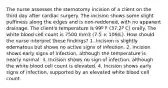 The nurse assesses the sternotomy incision of a client on the third day after cardiac surgery. The incision shows some slight puffiness along the edges and is non-reddened, with no apparent drainage. The client's temperature is 99º F (37.2º C) orally. The white blood cell count is 7500 mm3 (7.5 × 109/L). How should the nurse interpret these findings? 1. Incision is slightly edematous but shows no active signs of infection. 2. Incision shows early signs of infection, although the temperature is nearly normal. 3. Incision shows no sign of infection, although the white blood cell count is elevated. 4. Incision shows early signs of infection, supported by an elevated white blood cell count.