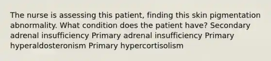 The nurse is assessing this patient, finding this skin pigmentation abnormality. What condition does the patient have? Secondary adrenal insufficiency Primary adrenal insufficiency Primary hyperaldosteronism Primary hypercortisolism