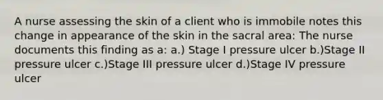 A nurse assessing the skin of a client who is immobile notes this change in appearance of the skin in the sacral area: The nurse documents this finding as a: a.) Stage I pressure ulcer b.)Stage II pressure ulcer c.)Stage III pressure ulcer d.)Stage IV pressure ulcer