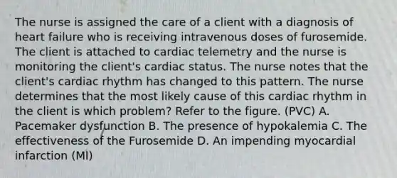 The nurse is assigned the care of a client with a diagnosis of heart failure who is receiving intravenous doses of furosemide. The client is attached to cardiac telemetry and the nurse is monitoring the client's cardiac status. The nurse notes that the client's cardiac rhythm has changed to this pattern. The nurse determines that the most likely cause of this cardiac rhythm in the client is which problem? Refer to the figure. (PVC) A. Pacemaker dysfunction B. The presence of hypokalemia C. The effectiveness of the Furosemide D. An impending myocardial infarction (MI)