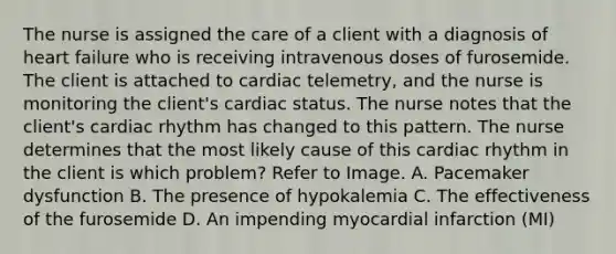 The nurse is assigned the care of a client with a diagnosis of heart failure who is receiving intravenous doses of furosemide. The client is attached to cardiac telemetry, and the nurse is monitoring the client's cardiac status. The nurse notes that the client's cardiac rhythm has changed to this pattern. The nurse determines that the most likely cause of this cardiac rhythm in the client is which problem? Refer to Image. A. Pacemaker dysfunction B. The presence of hypokalemia C. The effectiveness of the furosemide D. An impending myocardial infarction (MI)